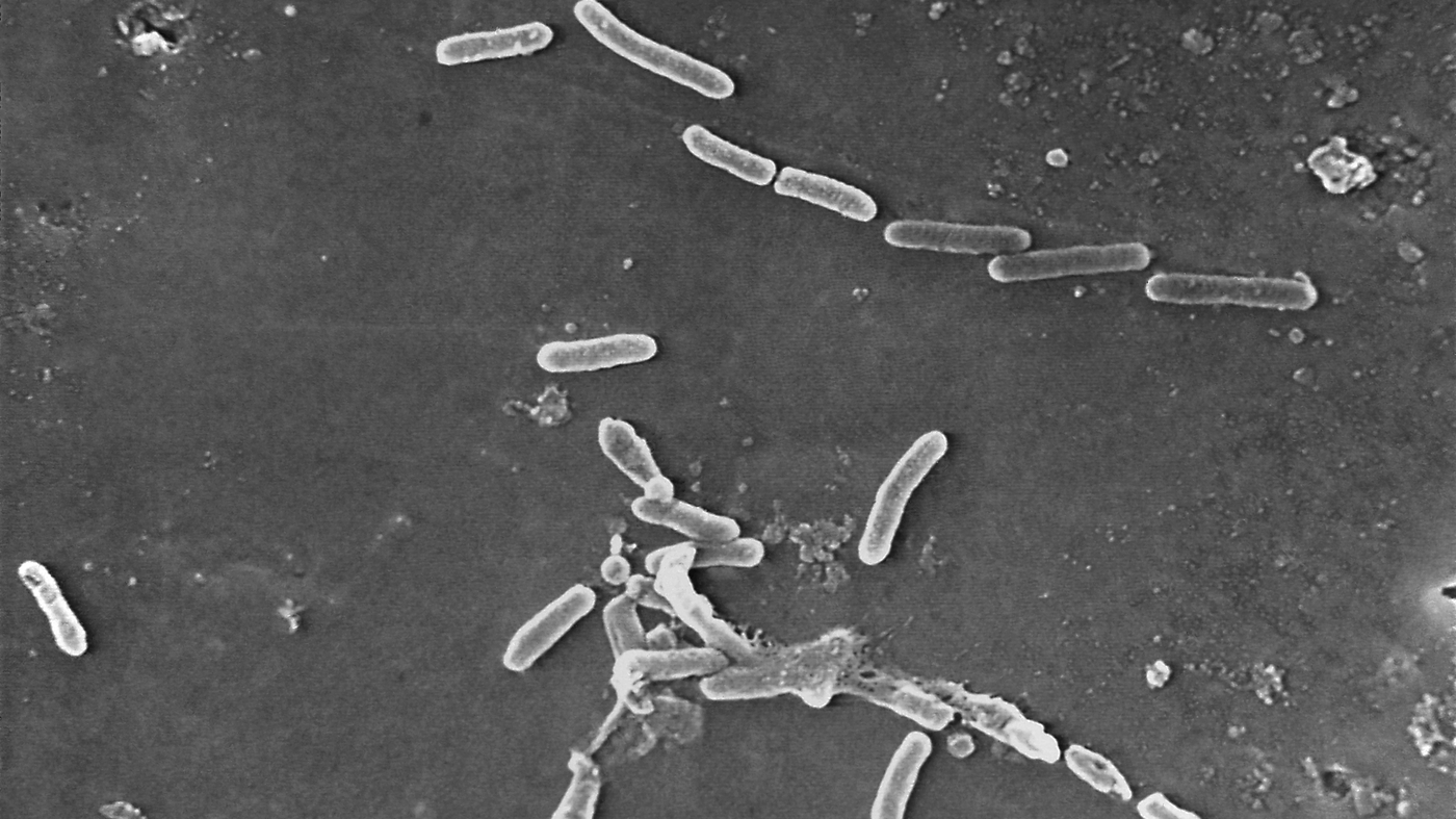 Recalled eyedrops are linked to Pseudomonas aeruginosa infections, CDC claims : NPR