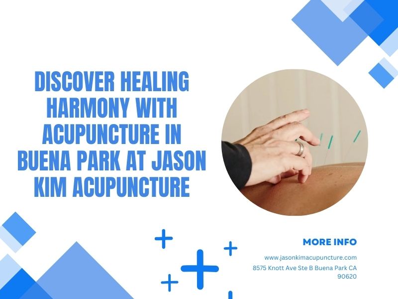 Discover Healing Harmony with Acupuncture in Buena Park at Jason Kim